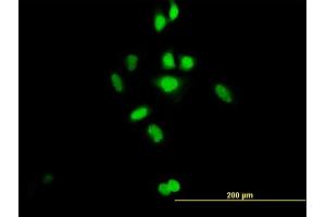 Immunofluorescence of purified MaxPab antibody to C21orf66 on HeLa cell.