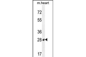 B3GAT2 Antibody (Center) (ABIN654428 and ABIN2844164) western blot analysis in mouse heart tissue lysates (35 μg/lane). (B3GAT2 Antikörper  (AA 123-150))
