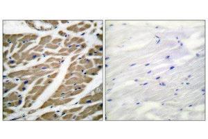 Immunohistochemistry (IHC) image for anti-Sodium Channel (Internal Region), (pan) antibody (ABIN1848776) (Sodium Channel Antikörper  (Internal Region, pan))