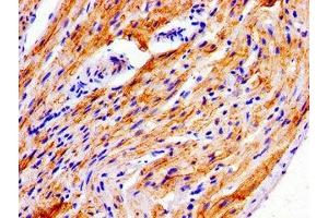 Immunohistochemistry of paraffin-embedded human heart tissue using ABIN7165855 at dilution of 1:100 (NDRG4 Antikörper  (AA 210-331))