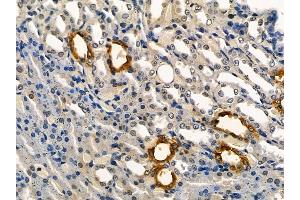 AQP2 Mouse Monoclonal Antibody at 1/100 staining rat kidney tissue by IHC-P. (AQP2 Antikörper)