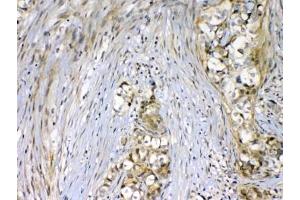 Immunohistochemistry (IHC) image for anti-VEGF Receptor 2 (VEGFR2) antibody (ABIN5646980)