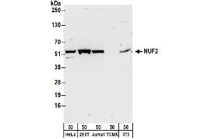 anti-NUF2, NDC80 Kinetochore Complex Component (NUF2) (AA 414-464) antibody