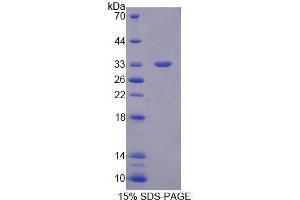 SDS-PAGE (SDS) image for phospholipase C beta 2 (PLCb2) (AA 1-250) protein (His tag) (ABIN4990043) (Phospholipase C beta 2 Protein (AA 1-250) (His tag))