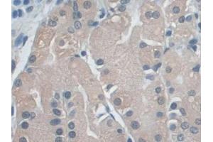 Immunohistochemistry (IHC) image for anti-Ezrin (EZR) (AA 1-295) antibody (ABIN7440074)