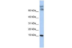 CKLF antibody used at 1 ug/ml to detect target protein. (CKLF Antikörper  (N-Term))