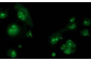 Anti-CDCP1 mouse monoclonal antibody (ABIN2454046) immunofluorescent staining of COS7 cells transiently transfected by pCMV6-ENTRY CDCP1 (RC220633). (CDCP1 Antikörper)