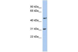WB Suggested Anti-DBT Antibody Titration: 0.