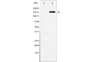 Western blot analysis of ASK1 phosphorylation expression in TNF-α treated MDA-MB-435 whole cell lysates,The lane on the left is treated with the antigen-specific peptide. (ASK1 Antikörper  (pSer83))