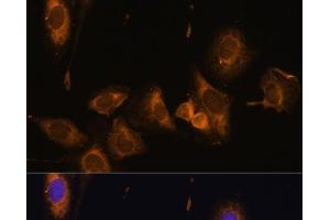 Immunofluorescence analysis of U-2 OS cells using RPL32 Polyclonal Antibody at dilution of 1:100 (40x lens). (RPL32 Antikörper)