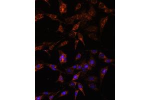 Immunofluorescence analysis of C6 cells using TBCC antibody (ABIN7271029) at dilution of 1:100. (TBCC Antikörper  (AA 1-346))