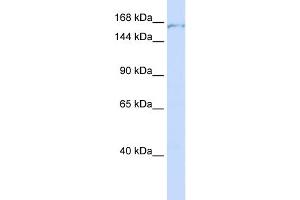 WB Suggested Anti-PDS5A Antibody Titration:  0. (PDS5A Antikörper  (C-Term))