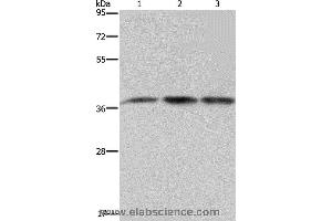 Western blot analysis of 293T and LoVo cell, human brain malignant glioma tissue, using CAB39 Polyclonal Antibody at dilution of 1:450 (CAB39 Antikörper)
