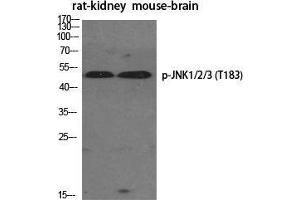 Western Blot (WB) analysis of specific cells using Phospho-JNK1/2/3 (T183) Polyclonal Antibody.