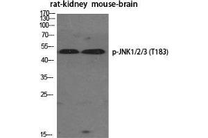 Western Blot (WB) analysis of specific cells using Phospho-JNK1/2/3 (T183) Polyclonal Antibody. (JNK Antikörper  (pThr183))