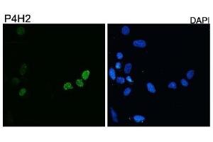 Diluted 1:10,000 on rhabdomyosarcoma cell line RD transfected with pCS2-DUX4. (DUX4 Antikörper  (C-Term))