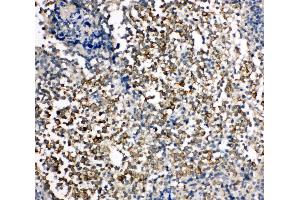 Anti-TIM 1 antibody, IHC(P) IHC(P): Human Tonsil Tissue (HAVCR1 Antikörper  (C-Term))