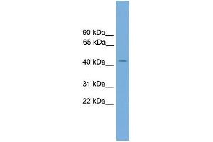 Human 721_B; WB Suggested Anti-AP1M2 Antibody Titration: 0. (AP1m2 Antikörper  (N-Term))