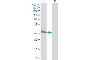 Western Blot analysis of CLIC1 expression in transfected 293T cell line by CLIC1 monoclonal antibody (M02), clone 3F9. (CLIC1 Antikörper  (AA 1-241))