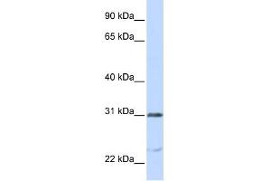 NUSAP1 antibody used at 1 ug/ml to detect target protein. (NUSAP1 Antikörper  (C-Term))