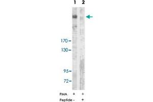 Western blot analysis of extracts from NIH/3T3 cells treated with PMA (125 ng/ml, 15 min), using ACACA polyclonal antibody . (Acetyl-CoA Carboxylase alpha Antikörper  (Ser80))