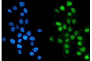 IF analysis of GTF2F2 using anti-GTF2F2 antibody (ABIN7599927).