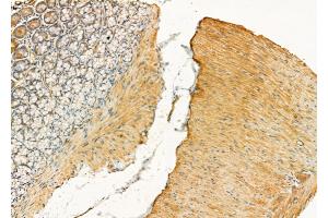 ABIN6258450 and ABIN6275840 at 1/100 staining Rat stomach tissue by IHC-P. (DDR1 Antikörper  (Internal Region))