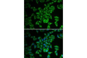 Immunofluorescence analysis of A549 cells using FXN antibody. (Frataxin Antikörper  (AA 42-210))