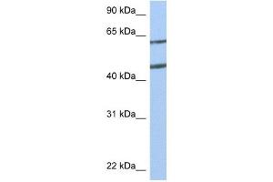 Netrin 4 antibody used at 1 ug/ml to detect target protein. (Netrin 4 Antikörper  (N-Term))