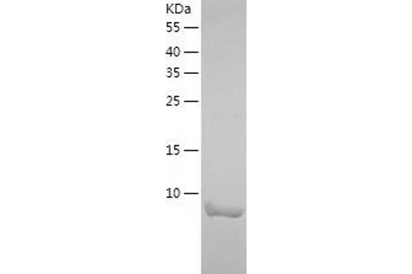 KAT2A Protein (AA 727-837) (His tag)