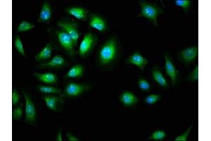 Immunofluorescence (IF) image for anti-Adhesion Molecule with Ig-Like Domain 2 (AMIGO2) (AA 420-522) antibody (ABIN7144036)