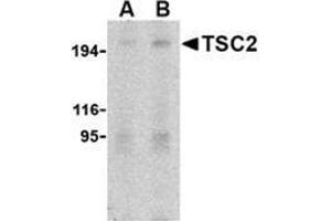 Western blot analysis of TSC2 in L1210 cell lysate with this product at (A) 2 and (B) 4 μg/ml. (Tuberin Antikörper  (N-Term))