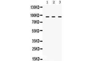 Western Blotting (WB) image for anti-Transporter 1, ATP-Binding Cassette, Sub-Family B (MDR/TAP) (TAP1) (AA 438-471), (Middle Region) antibody (ABIN3043943) (TAP1 Antikörper  (Middle Region))