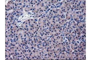 Immunohistochemical staining of paraffin-embedded Human pancreas tissue using anti-KATNAL1 mouse monoclonal antibody. (KATNAL1 Antikörper)