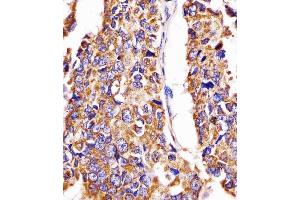 Immunohistochemistry (Paraffin-embedded Sections) (IHC (p)) image for anti-Heat Shock 60kDa Protein 1 (Chaperonin) (HSPD1) (AA 340-374) antibody (ABIN6242389)