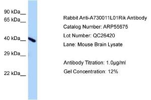 Western Blotting (WB) image for anti-Endonuclease V (ENDOV) (Middle Region) antibody (ABIN2786314)