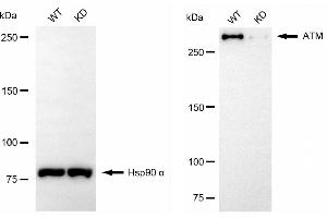 Western blotting analysis using ATM antibody (ABIN7797667). (Rekombinanter ATM Antikörper)