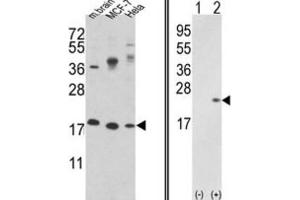 Western Blotting (WB) image for anti-Cofilin 1 (CFL1) antibody (ABIN3001704) (Cofilin Antikörper)