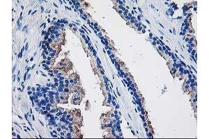 Immunohistochemical staining of paraffin-embedded Human prostate tissue using anti-TBC1D21 mouse monoclonal antibody. (TBC1D21 Antikörper)