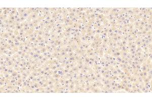 Detection of ITIH4 in Rat Liver Tissue using Polyclonal Antibody to Inter Alpha-Globulin Inhibitor H4 (ITIH4) (ITIH4 Antikörper  (AA 478-722))