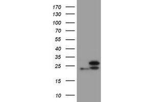 Image no. 1 for anti-Ubiquitin-Conjugating Enzyme E2E 3 (UBE2E3) antibody (ABIN1501626) (UBE2E3 Antikörper)