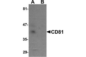 Western Blotting (WB) image for anti-CD81 (CD81) (N-Term) antibody (ABIN1031309) (CD81 Antikörper  (N-Term))