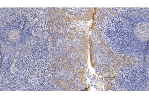 Detection of CK17 in Human Tonsil Tissue using Monoclonal Antibody to Cytokeratin 17 (CK17) (KRT17 Antikörper  (AA 252-393))