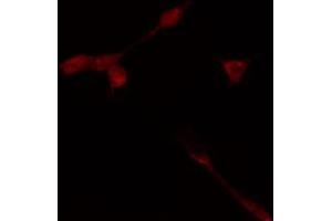 ABIN6274368 staining HeLa cells by IF/ICC. (TAF1A Antikörper  (Internal Region))