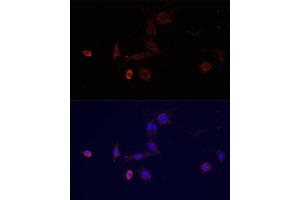 Immunofluorescence analysis of PC-12 cells using WDR81 antibody (ABIN6294099) at dilution of 1:100. (WDR81 Antikörper)