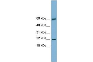 WB Suggested Anti-LGALS14 Antibody Titration:  0. (LGALS14 Antikörper  (N-Term))