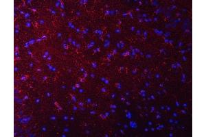 IF analysis of Septin 2/SEPTIN2 using anti-Septin 2/SEPTIN2 antibody (ABIN7599275). (Septin 2 Antikörper  (AA 1-326))
