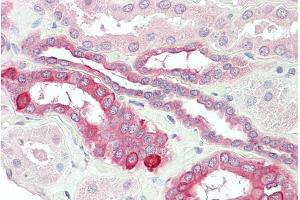 Immunohistochemistry (IHC) image for anti-Tumor Necrosis Factor Receptor Superfamily, Member 14 (TNFRSF14) (Internal Region) antibody (ABIN185517)