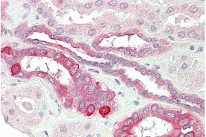 ABIN185517 (5µg/ml) staining of paraffin embedded Human Kidney. (HVEM Antikörper  (Internal Region))