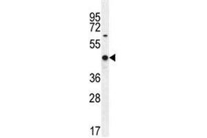 Western Blotting (WB) image for anti-Wilms Tumor 1 (WT1) (AA 346-375) antibody (ABIN3029622)